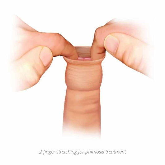 Treat Phimosis at Home with the 2-Finger Stretching Method – No Tools or Rings Required!