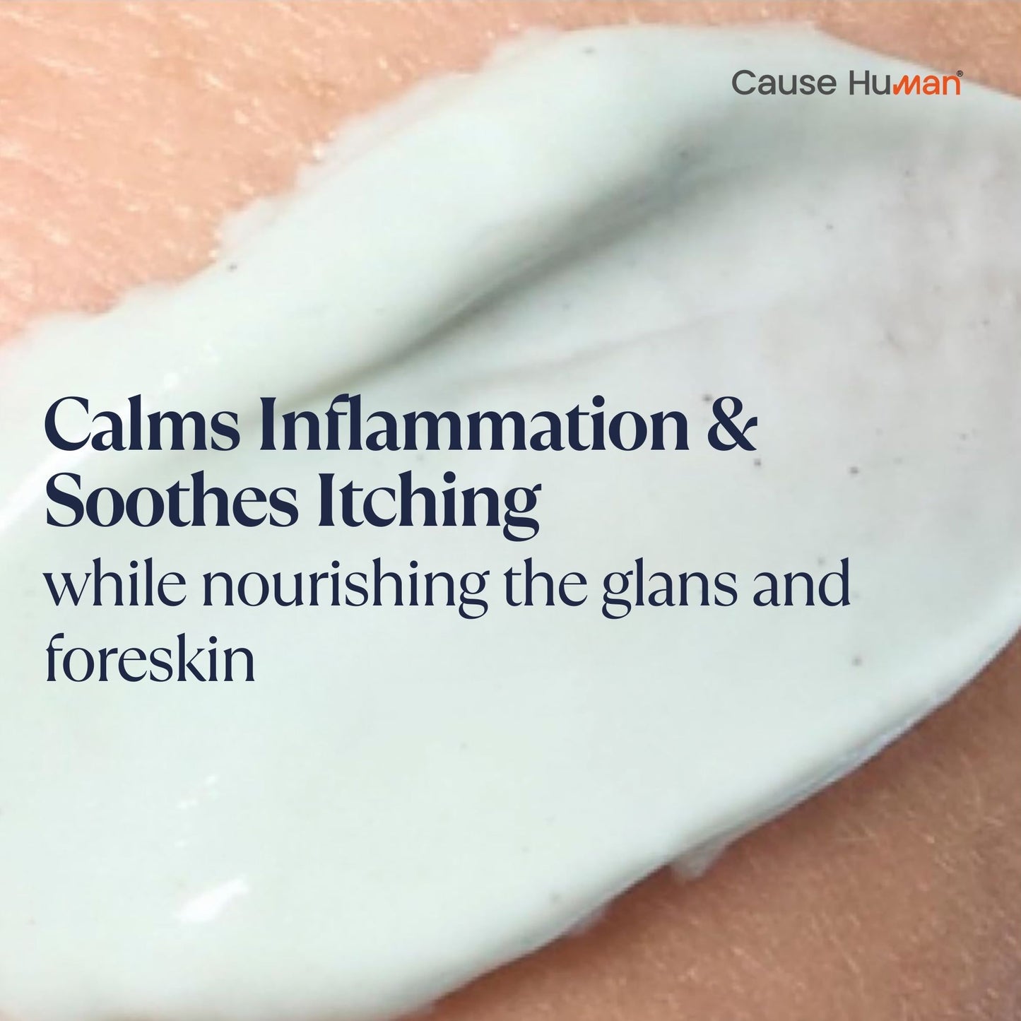Balanitis Relief Cream for Men – Soothes Redness, Itching & Dryness – Safe for Glans & Foreskin – 100g