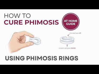Phimosis Stretching Rings With Phimosis cream